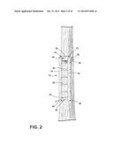 MODULAR TREE-MOUNTABLE HUNTING STAND diagram and image