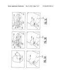 Method for Producing a Dental Element or Aid for Adjusting the Teeth,     Face-Bow and Articulator diagram and image