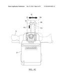 Selected Image Acquisition Technique To Optimize Patient Model     Construction diagram and image