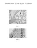 Color Decomposition in Histology diagram and image