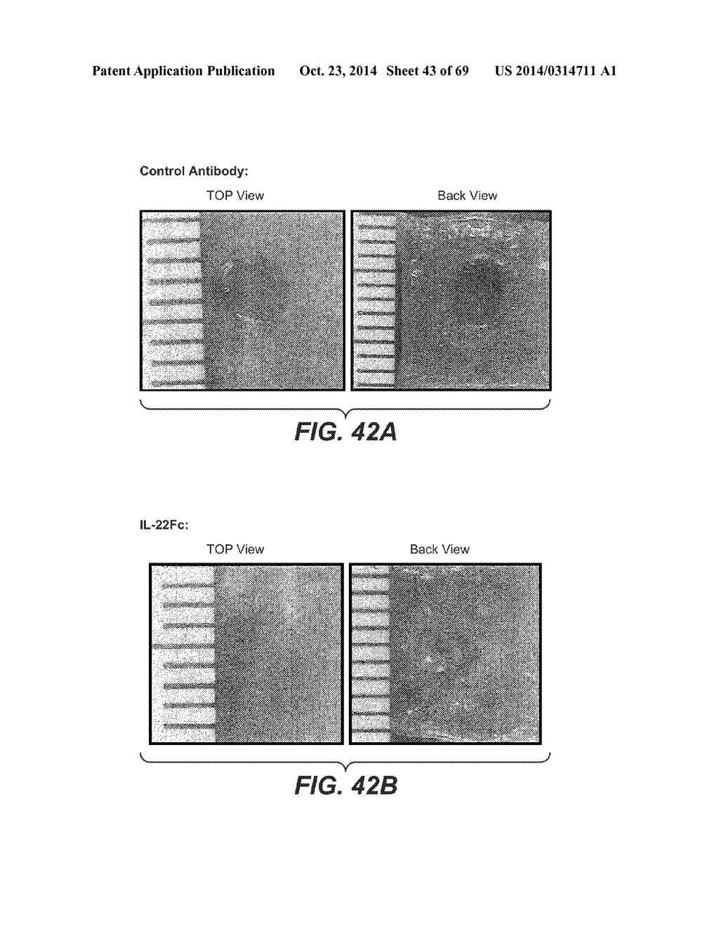 IL-22 POLYPEPTIDES AND IL-22 Fc FUSION PROTEINS AND METHODS OF USE - diagram, schematic, and image 44