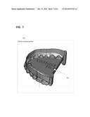 FABRICATION OF AN ORTHODONTIC ALIGNER FROM A NEGATIVE MOLD DESIGNED BY A     COMPUTATIONAL DEVICE diagram and image