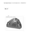 FABRICATION OF AN ORTHODONTIC ALIGNER FROM A NEGATIVE MOLD DESIGNED BY A     COMPUTATIONAL DEVICE diagram and image