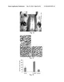 ACTIVATED COLLAGEN SCAFFOLD MATERIALS AND THEIR SPECIAL FUSED ACTIVE     RESTORATION FACTORS diagram and image