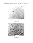 METHODS FOR IMPROVING THE BIOACTIVITY CHARACTERISTICS OF A SURFACE AND     OBJECTS WITH SURFACES IMPROVED THEREBY diagram and image