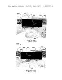 METHODS FOR IMPROVING THE BIOACTIVITY CHARACTERISTICS OF A SURFACE AND     OBJECTS WITH SURFACES IMPROVED THEREBY diagram and image