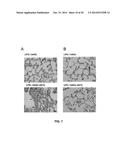 ENGINEERED STEM CELLS AND THEIR THERAPEUTIC USE diagram and image