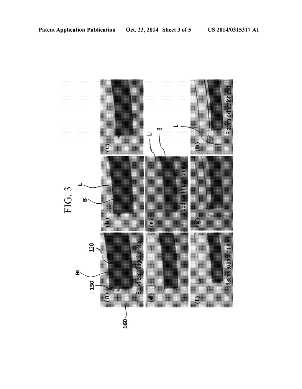 DISK-TYPE MICROFLUID SYSTEM AND METHOD FOR CHECKING BLOOD STATUS - diagram, schematic, and image 04