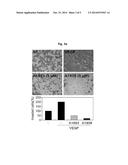 PHARMACEUTICAL COMPOSITION WITH ENHANCED EFFICACY FOR INHIBITING     ANGIOGENESIS diagram and image