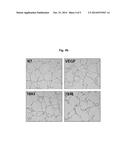 PHARMACEUTICAL COMPOSITION WITH ENHANCED EFFICACY FOR INHIBITING     ANGIOGENESIS diagram and image