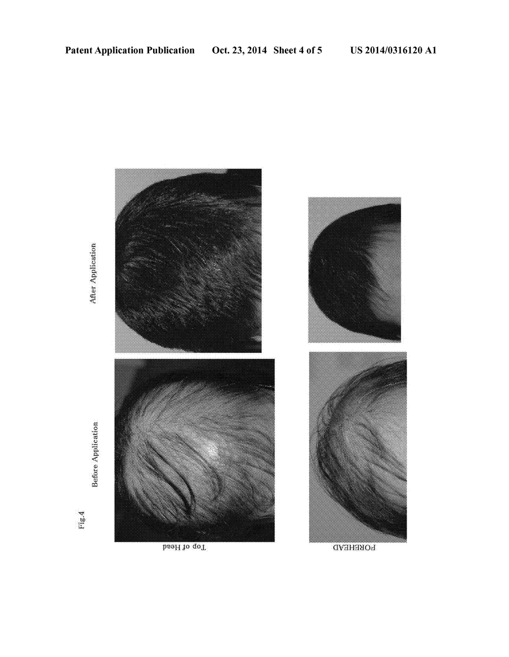 HAIR GROWTH AND HAIR RESTORATION MATERIAL - diagram, schematic, and image 05