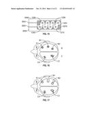 DOSIMETRICALLY CUSTOMIZABLE BRACHYTHERAPY CARRIERS AND METHODS THEREOF IN     THE TREATMENT OF TUMORS diagram and image