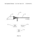 VIDEOSTROBOSCOPY OF VOCAL CHORDS WITH CMOS SENSORS diagram and image