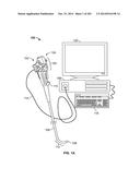 Circuit Board Assembly of a Multiple Viewing Elements Endoscope diagram and image