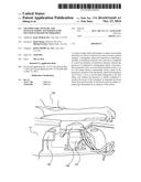 TRANSDUCERS, SYSTEMS, AND MANUFACTURING TECHNIQUES FOR FOCUSED ULTRASOUND     THERAPIES diagram and image