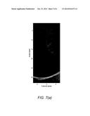 HIGH FREQUENCY ULTRASONIC CONVEX ARRAY TRANSDUCERS AND TISSUE IMAGING diagram and image