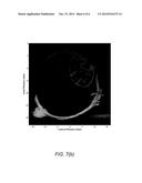 HIGH FREQUENCY ULTRASONIC CONVEX ARRAY TRANSDUCERS AND TISSUE IMAGING diagram and image