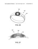 DEVICES AND METHODS FOR FACILITATING FLUID TRANSPORT diagram and image