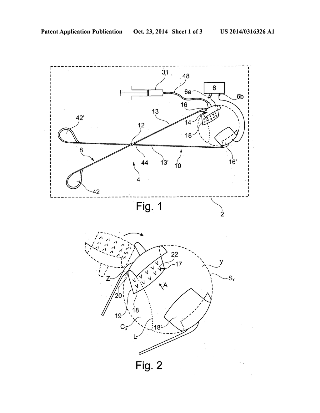 DEVICE FOR THE TREATMENT OF AN OCULAR DISEASE - diagram, schematic, and image 02