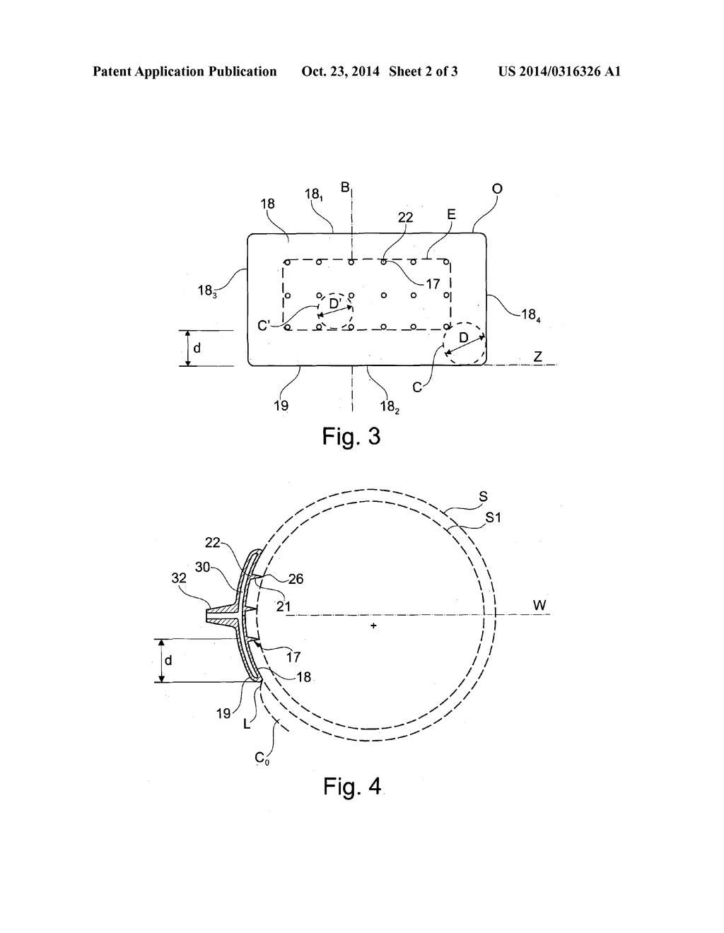 DEVICE FOR THE TREATMENT OF AN OCULAR DISEASE - diagram, schematic, and image 03