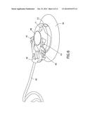 Insulin Pump Dermal Infusion Set Having Partially Integrated Mechanized     Cannula Insertion With Disposable Activation Portion diagram and image