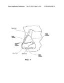 METHODS AND DEVICES TO TREAT NASAL AIRWAYS diagram and image