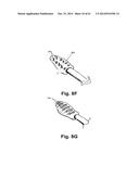 METHODS AND DEVICES TO TREAT NASAL AIRWAYS diagram and image