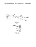 METHODS AND DEVICES TO TREAT NASAL AIRWAYS diagram and image