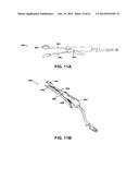 METHODS AND DEVICES TO TREAT NASAL AIRWAYS diagram and image