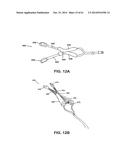 METHODS AND DEVICES TO TREAT NASAL AIRWAYS diagram and image