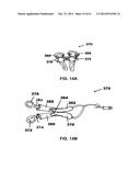 METHODS AND DEVICES TO TREAT NASAL AIRWAYS diagram and image