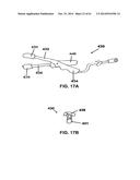 METHODS AND DEVICES TO TREAT NASAL AIRWAYS diagram and image