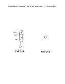 METHODS AND DEVICES TO TREAT NASAL AIRWAYS diagram and image