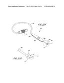 METHODS AND DEVICES TO TREAT NASAL AIRWAYS diagram and image