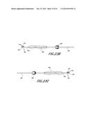 METHODS AND DEVICES TO TREAT NASAL AIRWAYS diagram and image