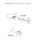 METHODS AND DEVICES TO TREAT NASAL AIRWAYS diagram and image