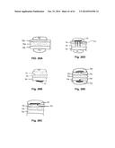 METHODS AND DEVICES TO TREAT NASAL AIRWAYS diagram and image