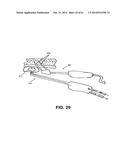 METHODS AND DEVICES TO TREAT NASAL AIRWAYS diagram and image