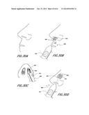 METHODS AND DEVICES TO TREAT NASAL AIRWAYS diagram and image