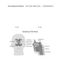 METHODS AND DEVICES TO TREAT NASAL AIRWAYS diagram and image