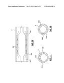 SYSTEMS AND METHODS RELATED TO SELECTIVE HEATING OF CRYOGENIC BALLOONS FOR     TARGETED CRYOGENIC NEUROMODULATION diagram and image