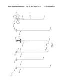 DENERVATION METHODS diagram and image