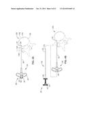 DENERVATION METHODS diagram and image