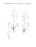 DENERVATION METHODS diagram and image