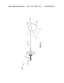 DENERVATION METHODS diagram and image