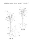 DENERVATION METHODS diagram and image