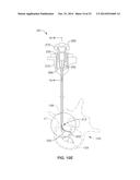 DENERVATION METHODS diagram and image