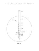 DENERVATION METHODS diagram and image