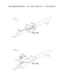 DENERVATION METHODS diagram and image