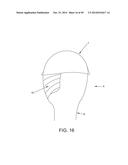 METHOD AND APPARATUS FOR RECONSTRUCTING A HIP JOINT, INCLUDING THE     PROVISION AND USE OF A NOVEL ARTHROSCOPIC DEBRIDEMENT TEMPLATE FOR     ASSISTING IN THE TREATMENT OF CAM-TYPE FEMOROACETABULAR IMPINGEMENT diagram and image